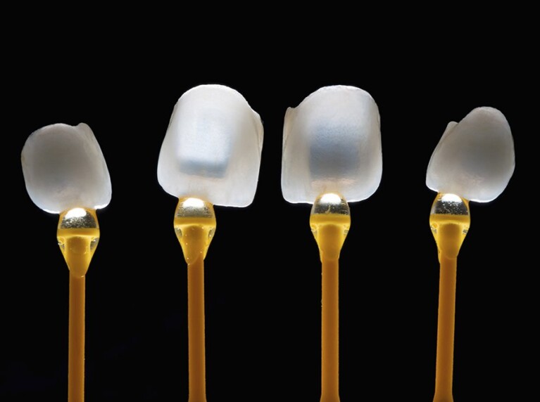 Dental Veneers